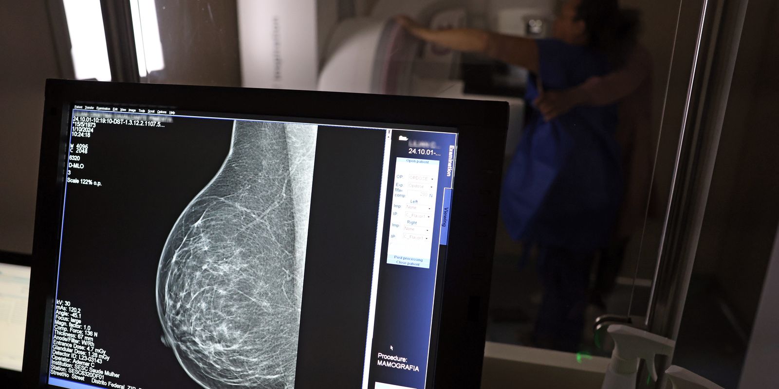 AGU processa médico que apontou mamografia como causadora de câncer