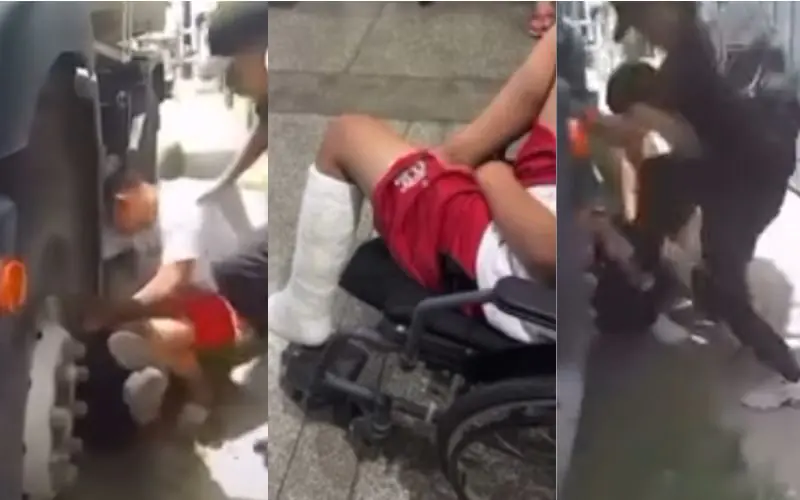 Garoto tem a perna quebrada por adolescentes no Jorge Teixeira