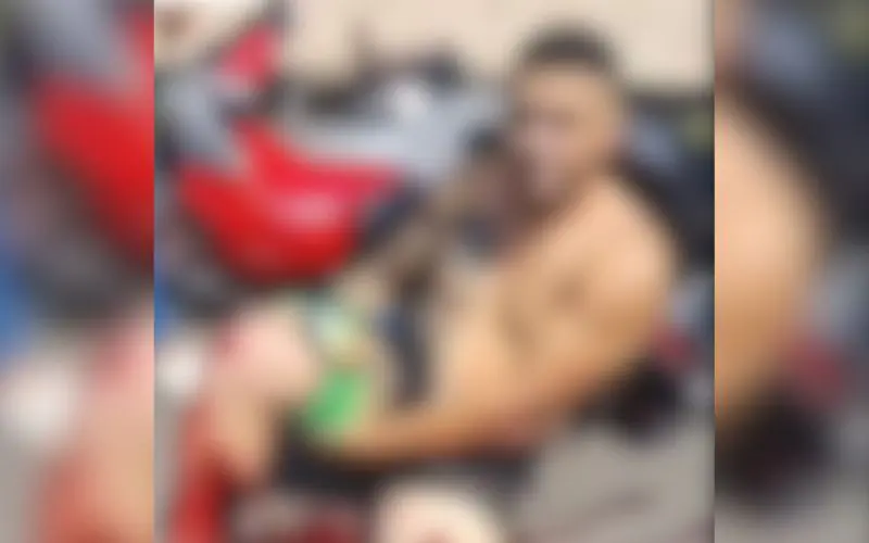 Motociclista tem a perna dilacerada em acidente no bairro Planalto