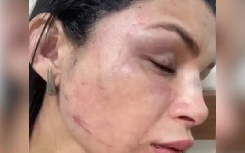 Verdadeiro assaltante que agrediu musa da Aparecida é preso