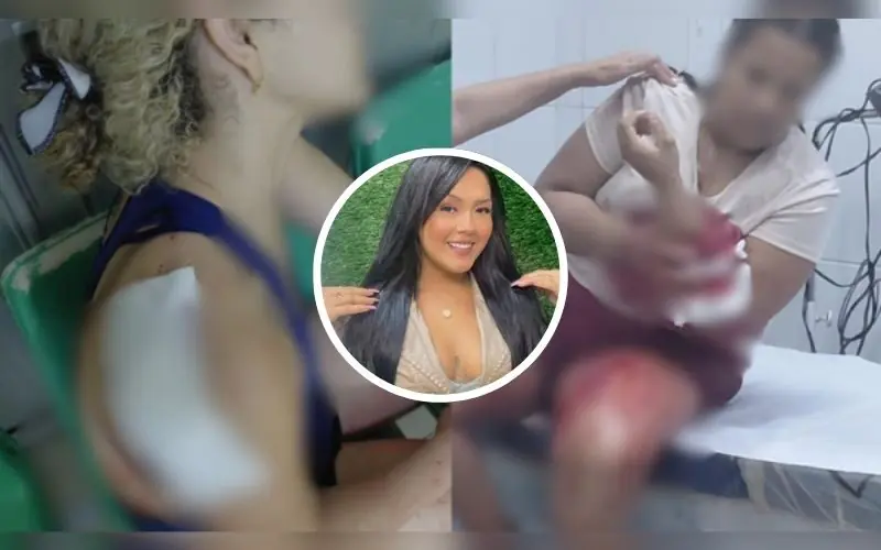 Polícia pede prisão de mulher que atacou vizinhas no bairro Flores