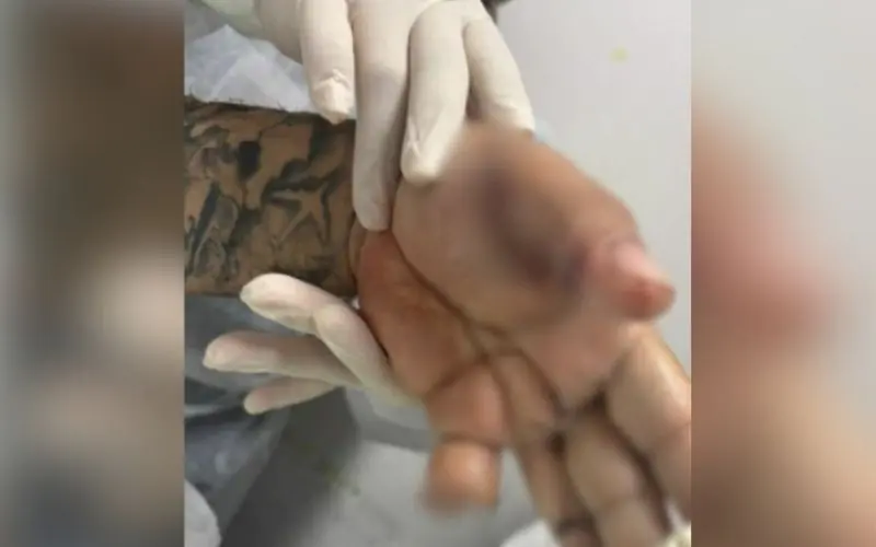 Motorista de aplicativo sofre ataque com terçado após corrida