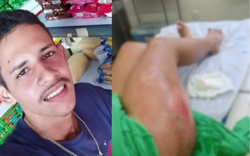 Homem atropela a ex e tenta passar caminhão sobre o corpo