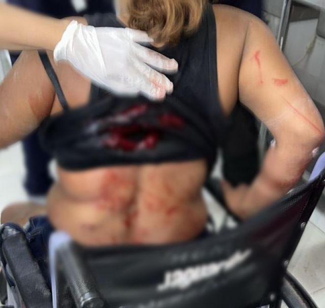 VÍDEO: Homem é preso por espancar e esfaquear mulher por ciúmes em Manacapuru