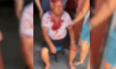 Idoso é brutalmente agredido durante assalto na Betânia
