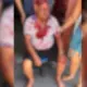Idoso é brutalmente agredido durante assalto na Betânia