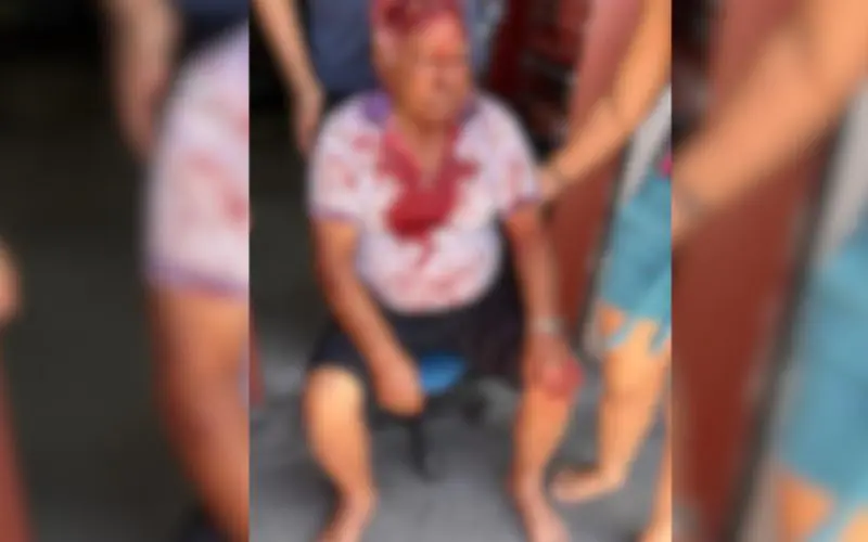 Idoso é brutalmente agredido durante assalto na Betânia