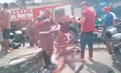Motociclista fica gravemente ferido em atropelamento no São José