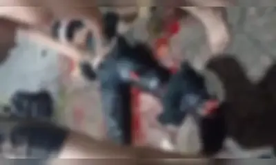 Motociclista sofre fratura exposta após colisão na zona centro-sul