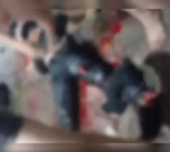 Motociclista sofre fratura exposta após colisão na zona centro-sul