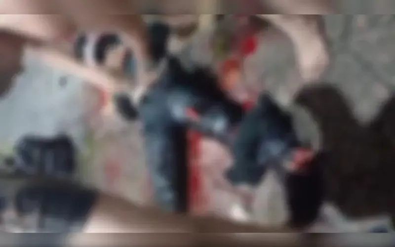 Motociclista sofre fratura exposta após colisão na zona centro-sul