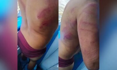 Trabalhador é brutalmente agredido por 'piratas dos rios' em Jutaí