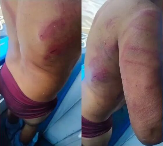 Trabalhador é brutalmente agredido por 'piratas dos rios' em Jutaí