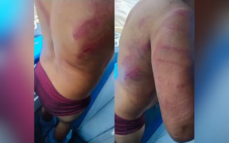 Trabalhador é brutalmente agredido por 'piratas dos rios' em Jutaí