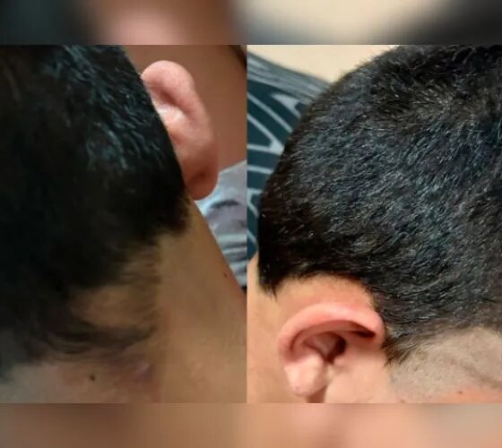 Aluno autista é agredido e tem cabelo raspado em escola de Manaus