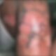 Mulher é agredida pelo companheiro e sofre queimaduras em Manaus