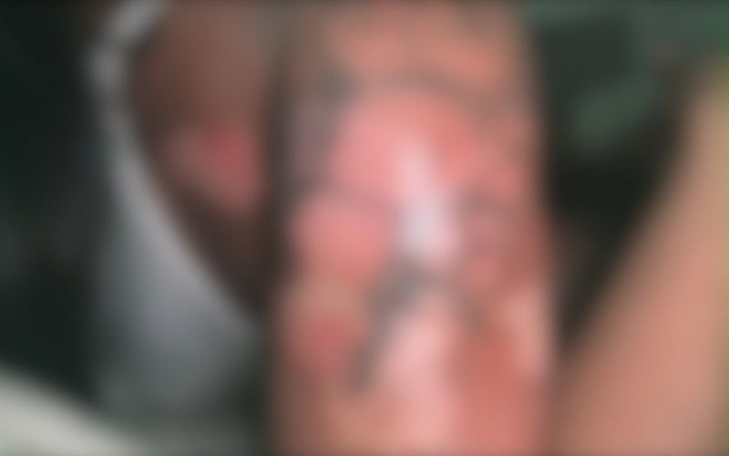 Mulher é agredida pelo companheiro e sofre queimaduras em Manaus