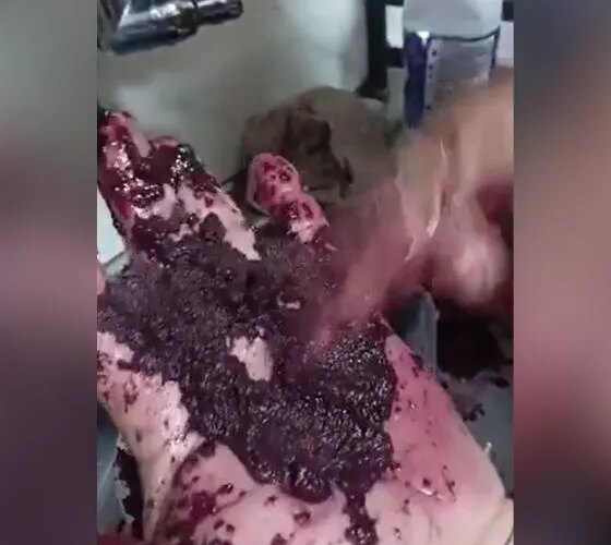 Cliente compra açaí 'miado' em Manaus diz que está cheio de papel higiênico
