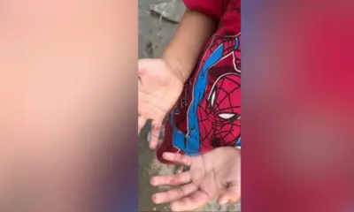 Menino de 5 anos é resgatado em Manaus após suspeita de maus-tratos
