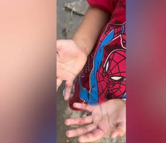 Menino de 5 anos é resgatado em Manaus após suspeita de maus-tratos