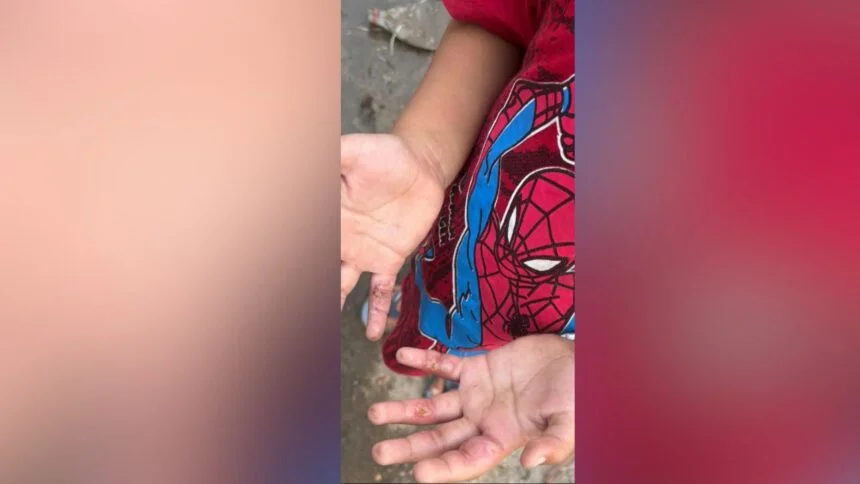 Menino de 5 anos é resgatado em Manaus após suspeita de maus-tratos