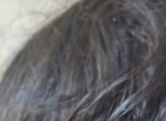 Menina de 12 anos é esfaque4da em escola particular; imagem forte